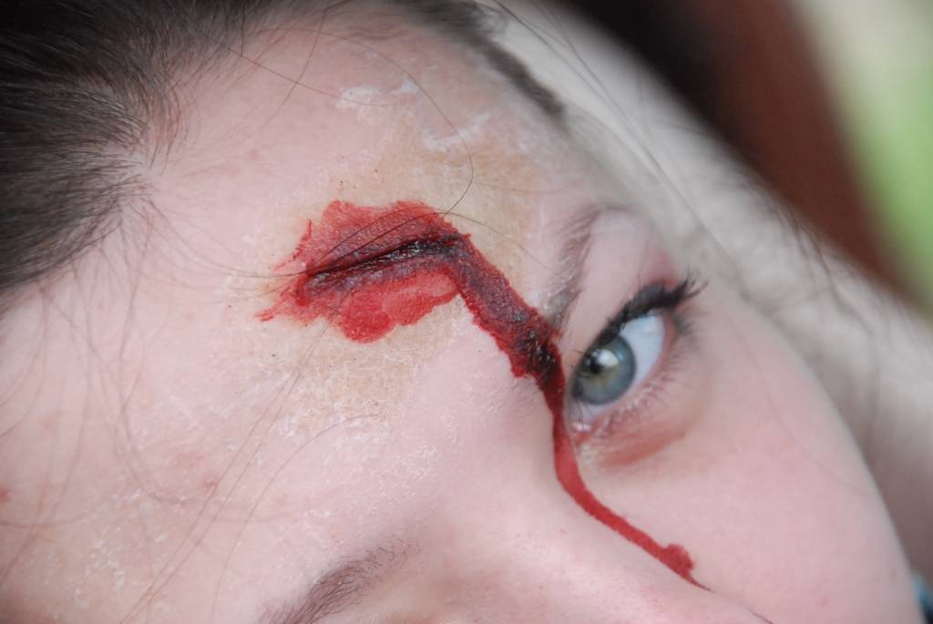 Piektdien, 14. maijā, no pulksten 11 pie 15. vidusskolas stāv neatliekamās medicīniskās palīdzības mašīna un ir liela rosība. Garāmbraucēji ir satraukušies, bet tam nav pamata - tur notiek Sarkanā Krusta Liepājas komitejas rīkotās pirmās...
Autors: Ilze Vainovska