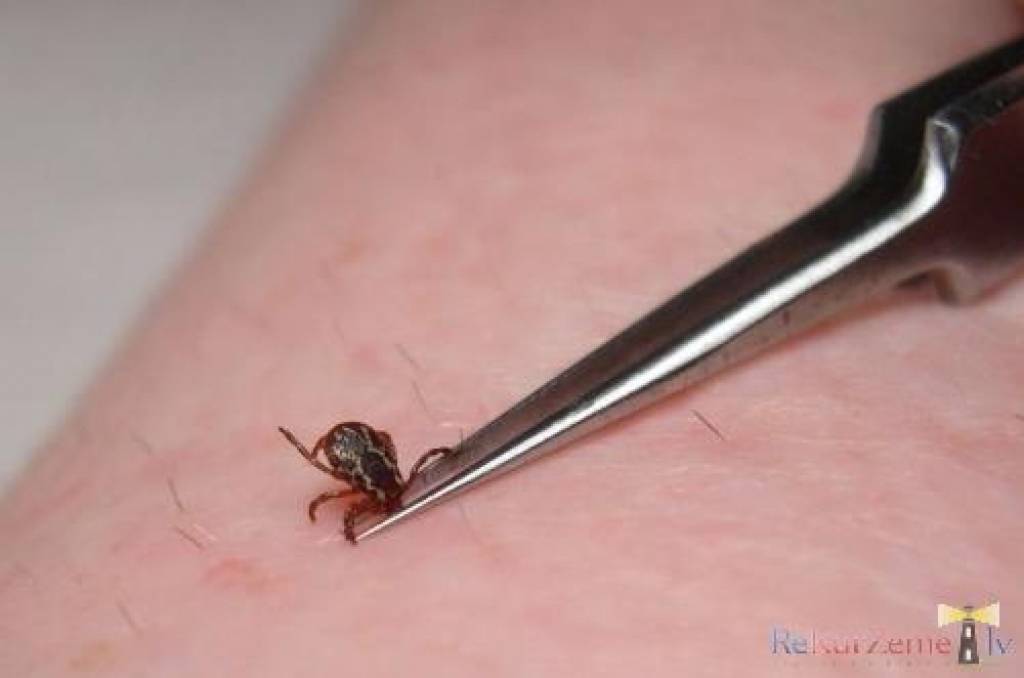 Autors: Publicitātes foto