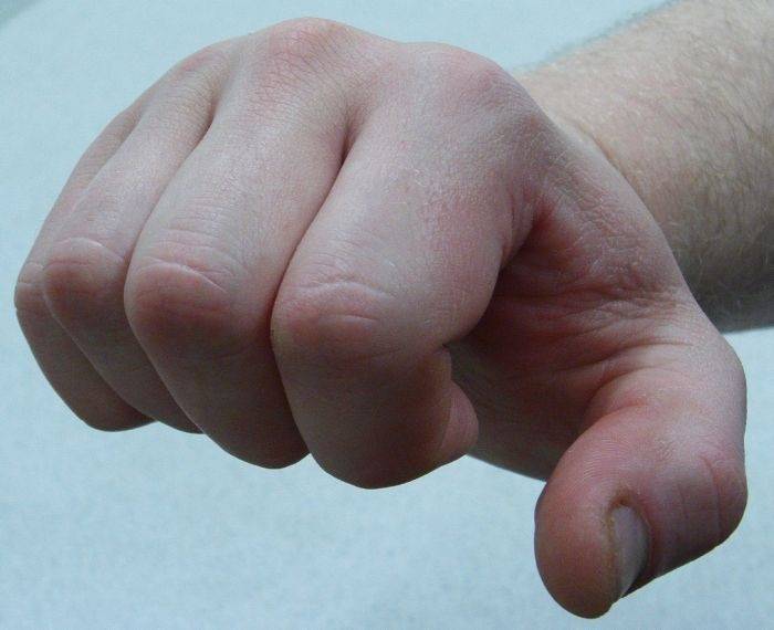 Autors: www.apollo.lv