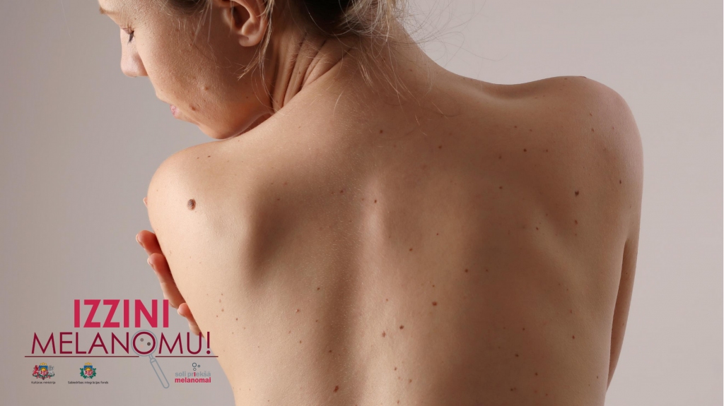 Autors: Publicitātes foto